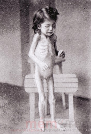 Fillette souffrant de tuberculose, Vienne, 1919
